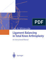 Ligament Balancing in Total Knee Arthroplasty