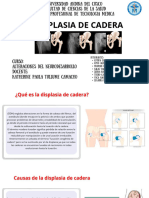 Displasia de Cadera Grupo 2