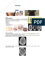 Neuro II