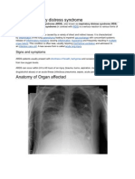 Acute Respiratory Distress Syndrome