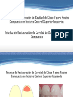 Preparacioncavitariaclasevestetica 131103154142 Phpapp02