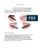 Tipos de Cepillado Dental - Periodoncia