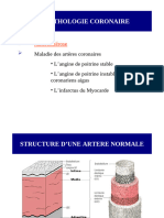 Angine de Poitrine Et Infarctus de Myocarde