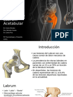 Lesiones de Labrum Acetabular