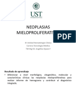 Neoplasias Mieloproliferativas PH+ LMC