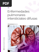 enfermedades-pulmonares-intersticiales-difusas