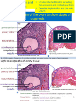 11.4b Fertilization and Implantation