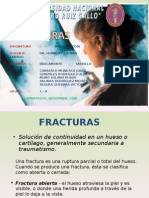 FRACTURAS