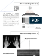 Metodo Radiografico