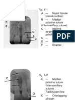 Normal Radiographic Dental Anatomy