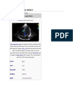 Ventricular Septal Defect