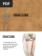 Fracture