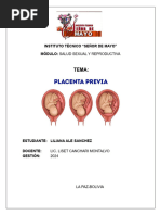 placenta previa con caratula