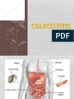 Colecistitis