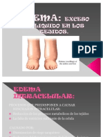 Edema Fisiologia 100303145326 Phpapp01