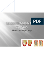 Regeneración Ósea Guiada