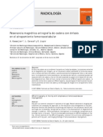 RM Atrapamiento Femoroacetabular