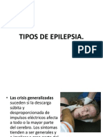 Epilepsia