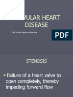 Valvular Heart Disease