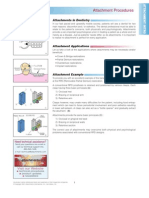 Attachment Procedures: Attachments in Dentistry