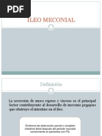 Ileo Meconial