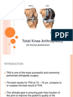 Total Knee Arthroplasty: DR Rouaa Mandurah