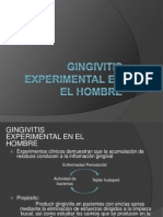 Gingivitis Experimental en El Hombre