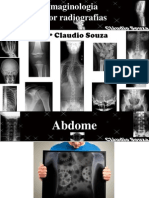 Aula 7 - Imaginologia Por Radiografias - Abdome. Prof. Claudio Souza - ATUALIZADA EM 05/2012