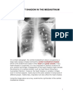 The Heart Shadow in The Mediatinum