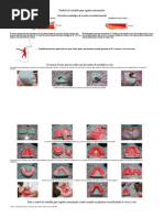 Rodetes de Mordida para Registro Intermaxilar