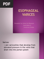 Esophageal Varices