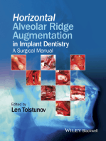 Horizontal Alveolar Ridge Augmentation in Implant Dentistry: A Surgical Manual