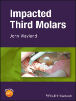 Impacted Third Molars