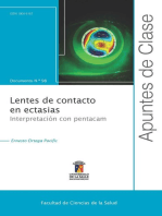 Lentes de contacto en ectasias: Interpretación con Pentacam