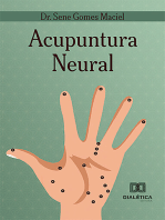 Acupuntura Neural