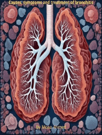 Causes, symptoms and treatment of bronchitis