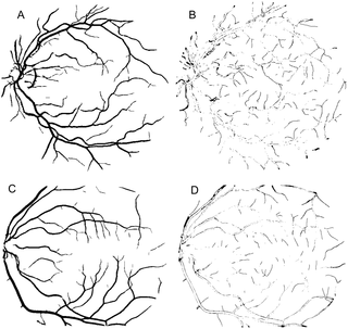 Fig 13