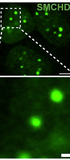 Genome-wide CRISPR screenings identified SMCHD1 as a host-restricting factor for AAV transduction