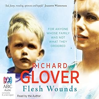 Flesh Wounds Audiobook By Richard Glover cover art