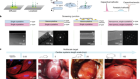 Monolithic silicon for high spatiotemporal translational photostimulation