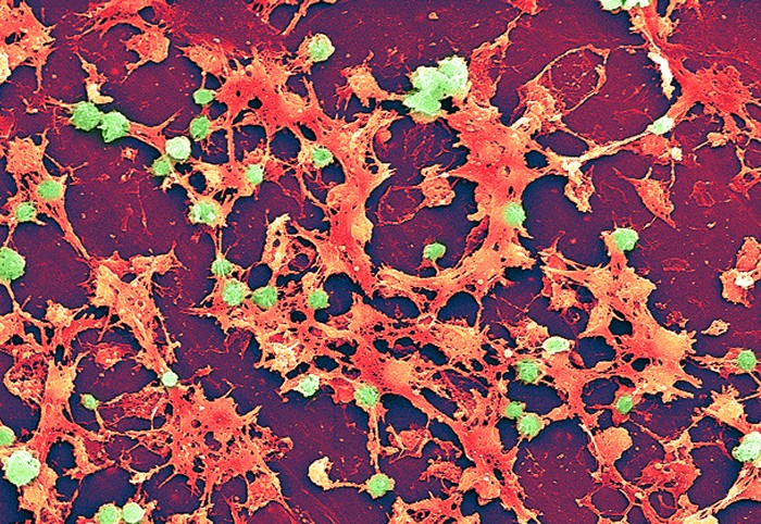 Scanning Electron Micrograph showing large numbers of Staphylococcus aureus bacteria in green and orange colours