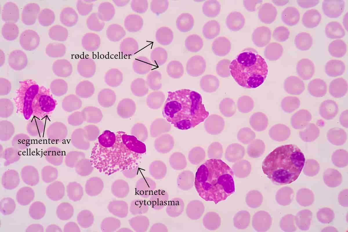 Eosinofile granulocytter