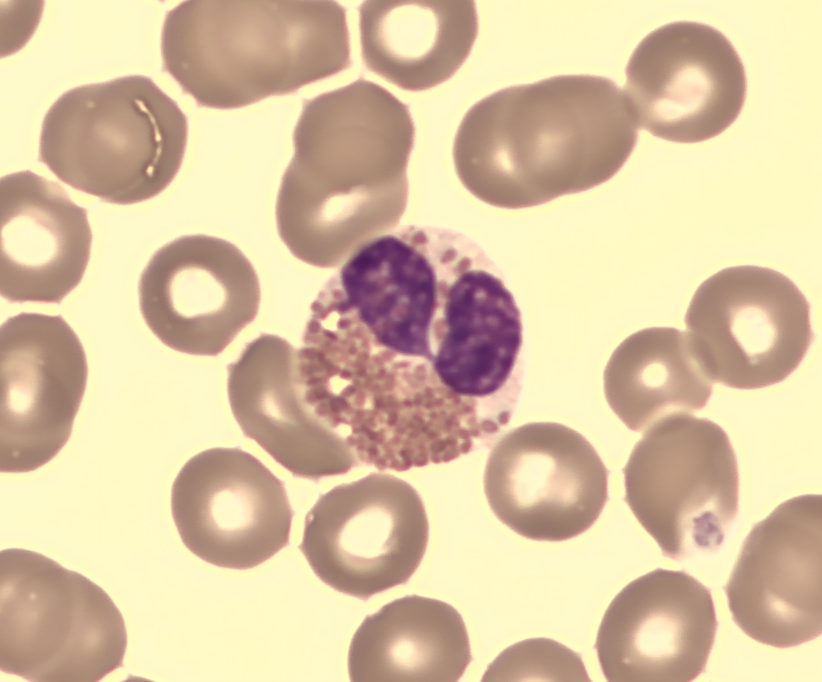 Eosinofil granulocytt