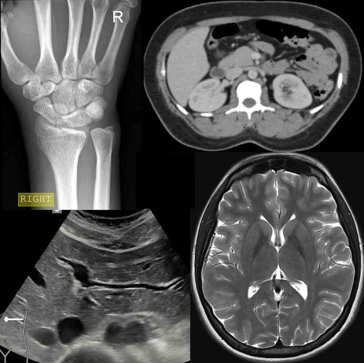 Radiologiske undersøkelser