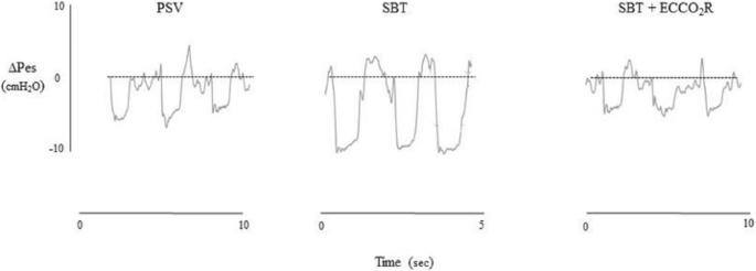 figure 28