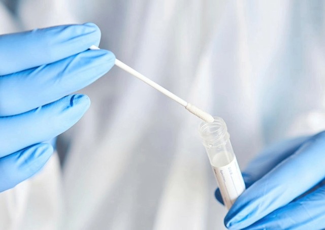 Scientist in a lab coat handling a clinical sample