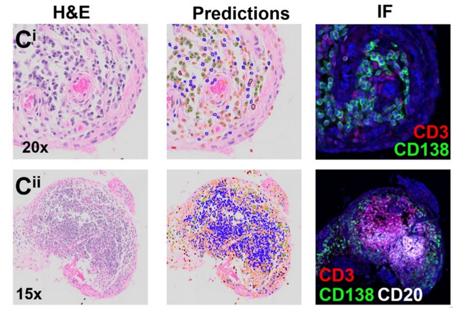 H&E histology slides and immunofluorescent images of B cells and T cells