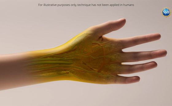 Illustration of a human hand as it might appear if the new tissue transparency effect proves effective in humans. Currently, the effect has only been tested with animals in a laboratory setting. Note that dyes may be harmful. Always exercise caution with dyes and do not consume directly, apply to people or animals, or otherwise misuse.