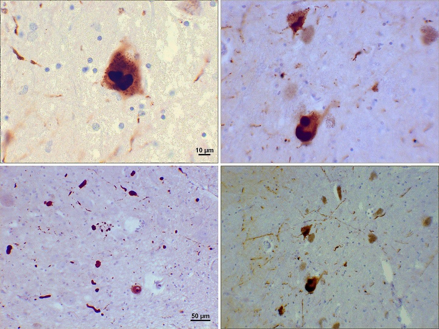 Background for Ensuring Open Access to Parkinson's Research