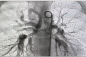 X-ray of a human chest